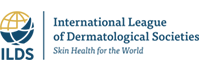 ILDS